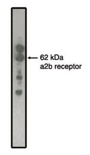 Mouse Rat Adrenergic Receptor Antibody