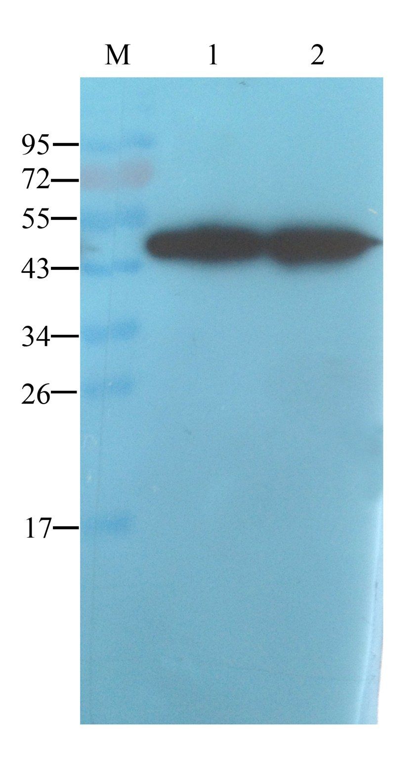 alpha 1 Antitrypsin antibody