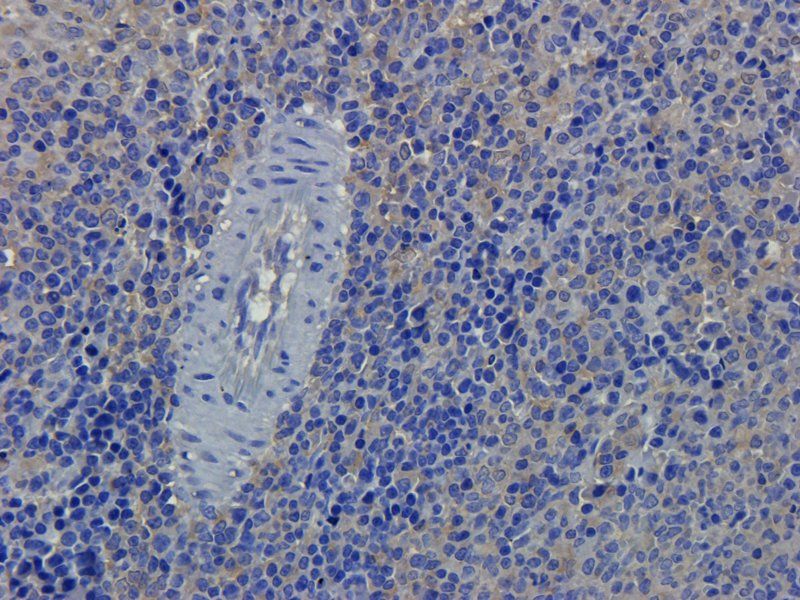 alpha 1 Antitrypsin antibody