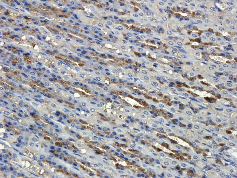 alpha 1 Antitrypsin antibody