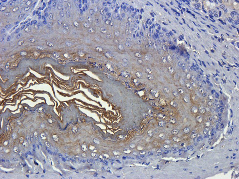 alpha 1 Antitrypsin antibody