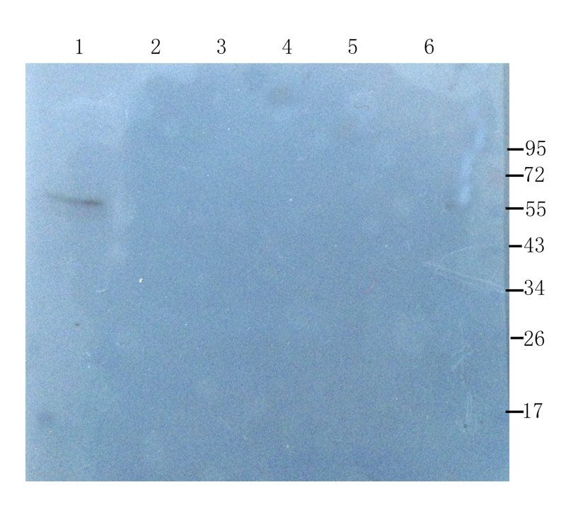 alpha 1 Antitrypsin antibody