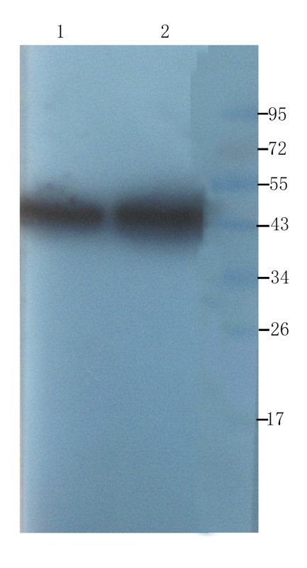 alpha 1 Antitrypsin antibody