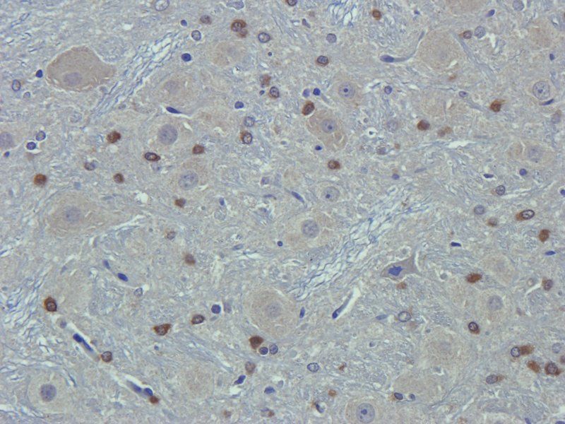 alpha 1 Antitrypsin antibody