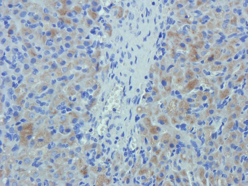 alpha 1 Antitrypsin antibody