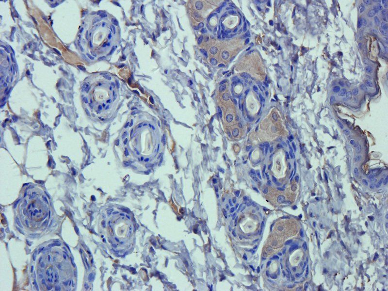 alpha 1 Antitrypsin antibody