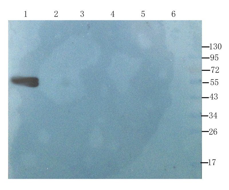 alpha 1 Antitrypsin antibody