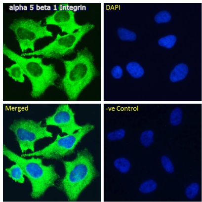 alpha 5 beta 1 Integrin antibody