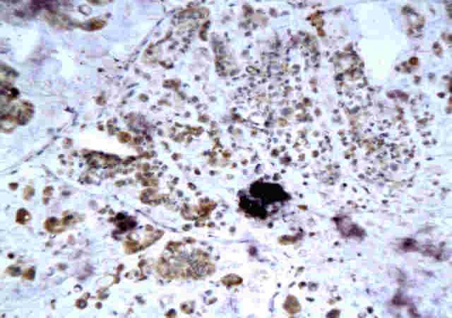 DEFA1/alpha Defensin 1 Rabbit Polyclonal Antibody