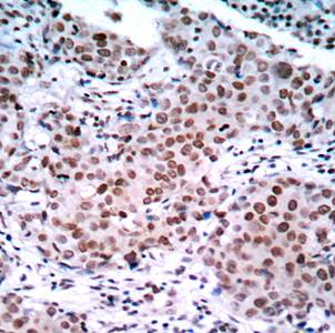 Estrogen Receptor-α (Phospho-Ser104) Antibody