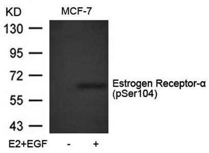 Estrogen Receptor-α (Phospho-Ser104) Antibody