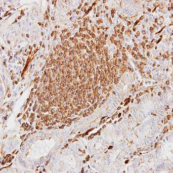 alpha sarcomeric Actin antibody