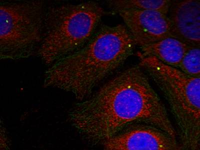 α-Synuclein (Phospho-Tyr125) Antibody