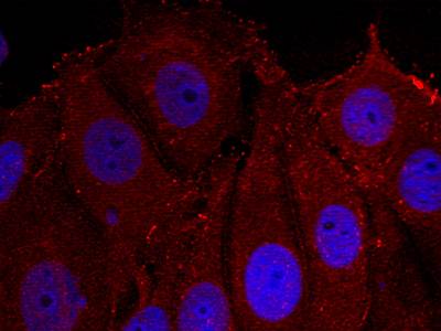 α-Synuclein (Phospho-Tyr133) Antibody