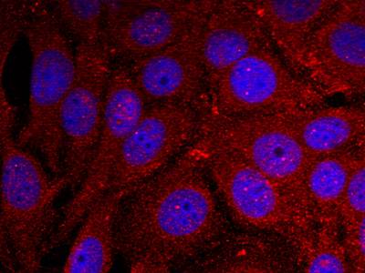 α-Synuclein (Phospho-Tyr136) Antibody