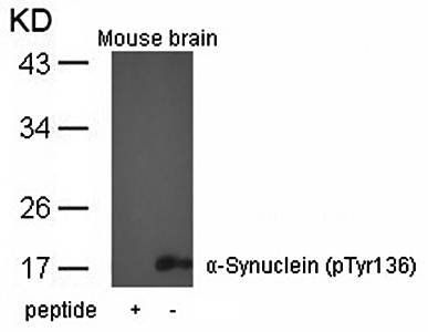 α-Synuclein (Phospho-Tyr136) Antibody