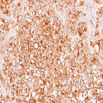 alpha Tubulin 4a antibody