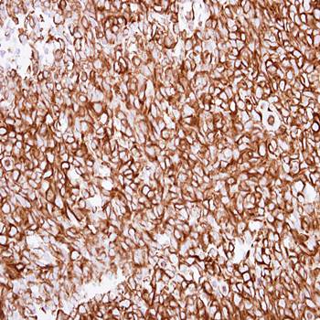 alpha Tubulin antibody