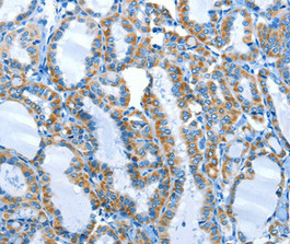ALPK1 antibody