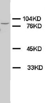 Alkaline Phosphatase/ALPL Antibody