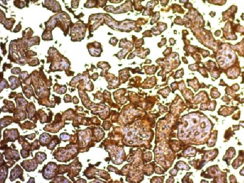 ALPP Antibody