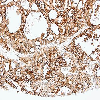 ALPPL2 antibody