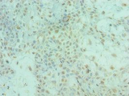 ALS2 Antibody