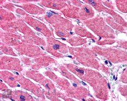 Goat anti-ALS2CR2 / ILPIP Antibody