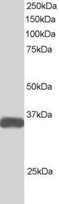 STRADB antibody