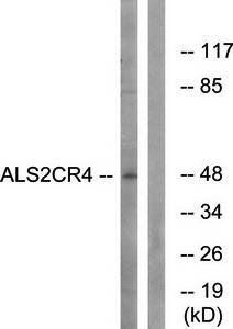 ALS2CR4 Antibody
