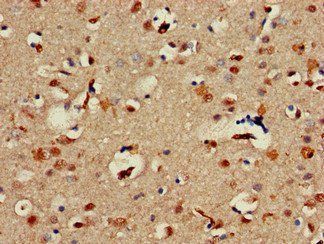 ALX1 Antibody