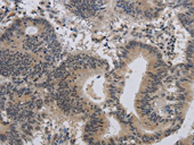 ALX4 Antibody