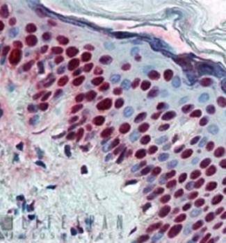 ALY/ Ref Monoclonal Antibody