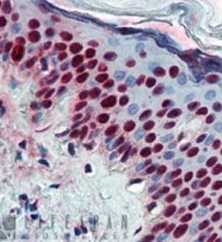 ALY/ Ref Monoclonal Antibody