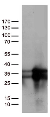 AMACR Antibody