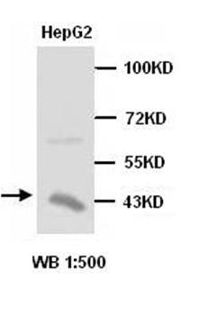 AMACR Rabbit Polyclonal Antibody