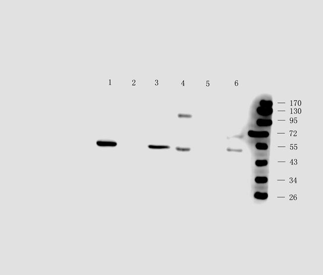 AMBP antibody