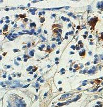 AMBP Rabbit Polyclonal Antibody