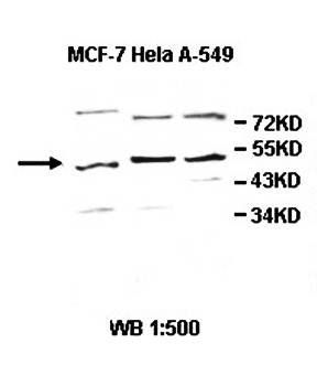 AMBP Rabbit Polyclonal Antibody