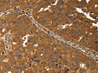 AMD1 Antibody
