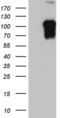 AMDHD1 Antibody