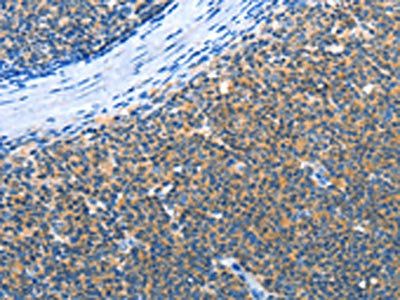 AMDHD2 Antibody