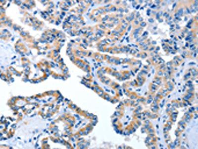 AMDHD2 Antibody