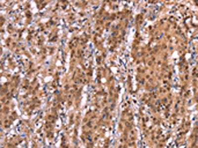 AMER1 antibody