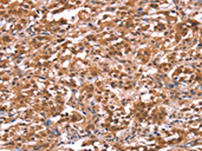 AMER1 Antibody