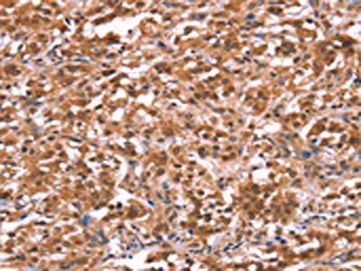 AMER1 antibody