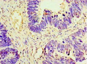 AMH Antibody