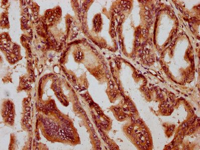 AMH Antibody