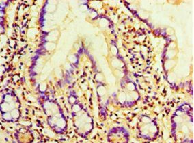 AMH Antibody