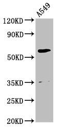 AMH antibody